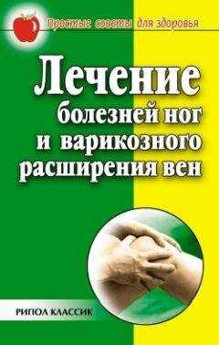 Евгения Сбитнева - Лечение болезней ног и варикозного расширения вен